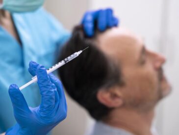 Man som genomgår hårtransplantation