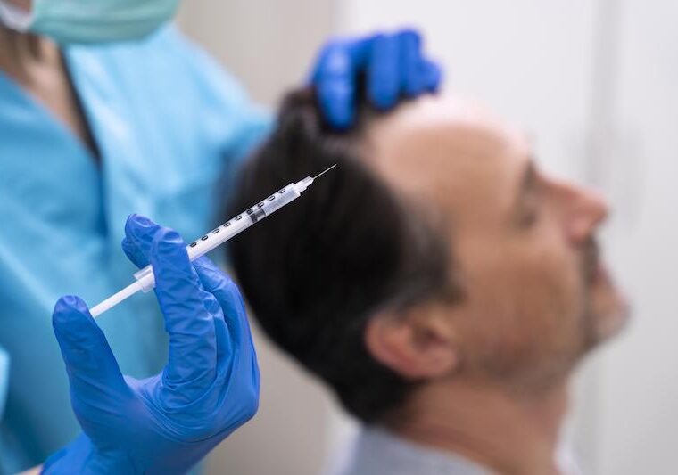 Man som genomgår hårtransplantation